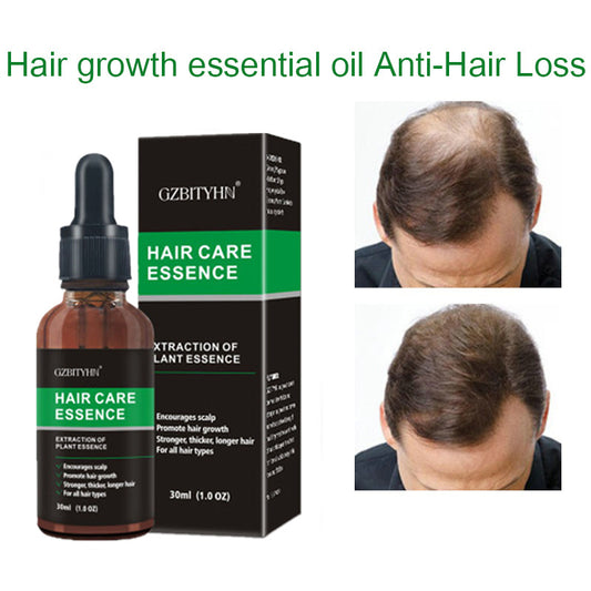 Anti-loss and Hair Growth Oil