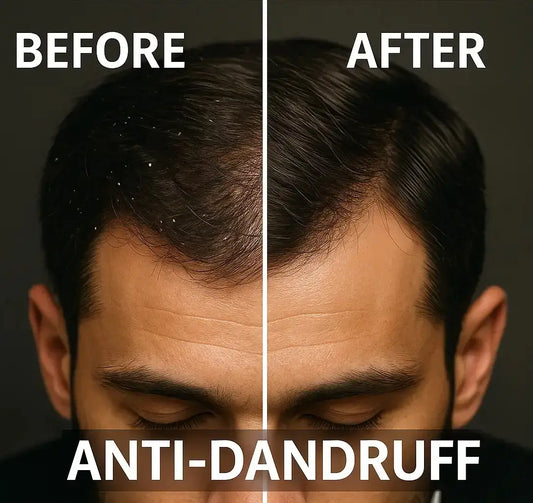 Anti-dandruff Shampoo